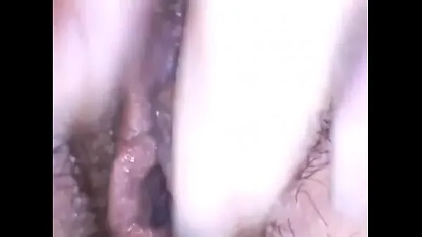 Grote Exploring a beautiful hairy pussy with medical endoscope have fun totale buis