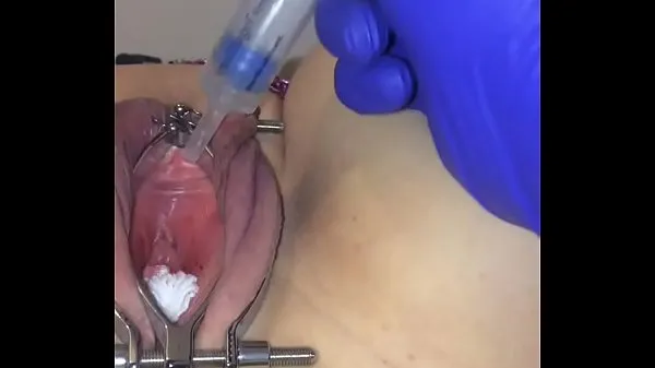 Gran Cómo insertar un catéter en la vejiga femenina tubo total