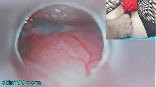 Big Asian Jav Pregnancy with Semen Injection in Cervix for Impregnation and Endoscopic Cam in Uterus to see inner total Tube